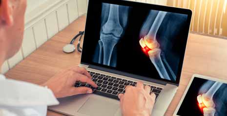 Revital Review And Advice On Body Centred Arthritis